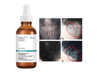 The Ordinary Multi-Peptide Serum For Hair Density 60ml - CANADA in Sri Lanka
