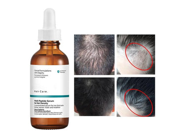 The Ordinary Multi-Peptide Serum For Hair Density 60ml - CANADA in Sri Lanka