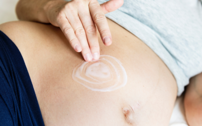 How-to-remove-stretch-mark-with-home-remedies
